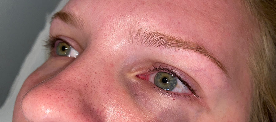 Image of Brows Before Treatment